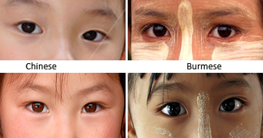 Difference Between Asian Eyes 75